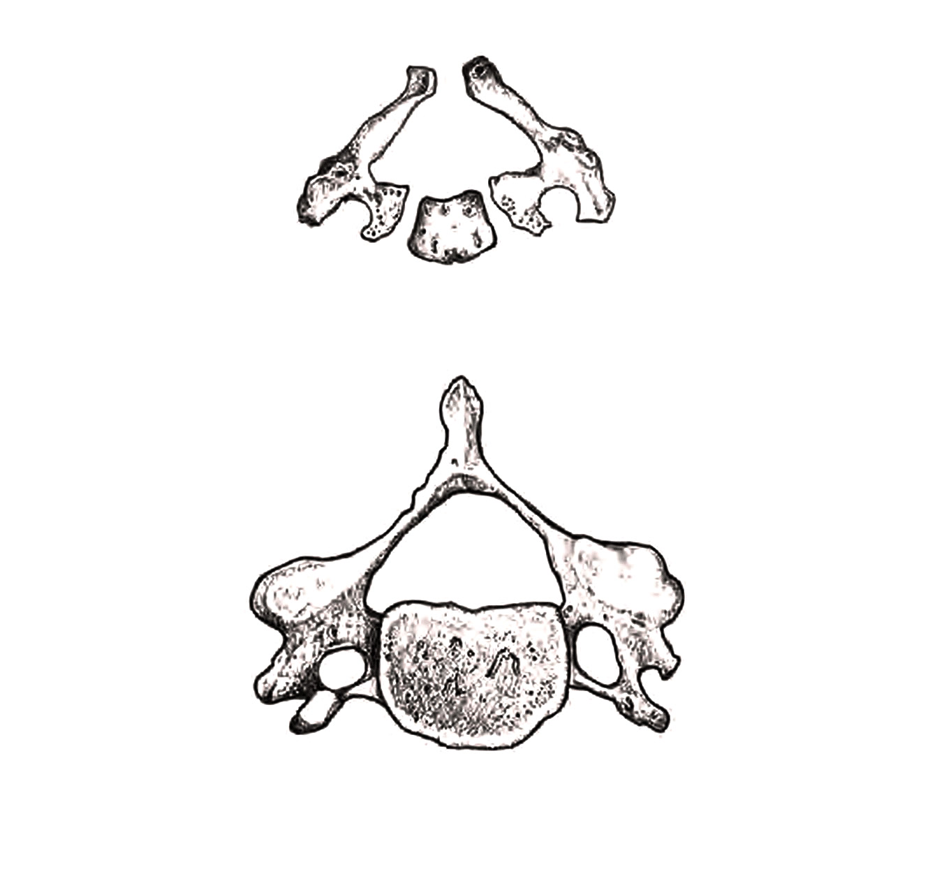 Drawings of a vertebra from two angles.
